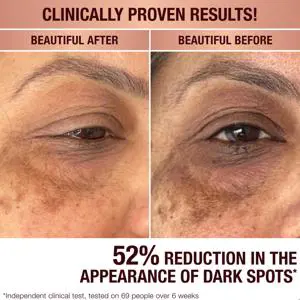 Charlotte Tilbury Dark Spot Correcting Radiance Recovery Serum 10ml